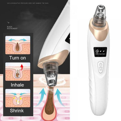 Facial Blackhead Remover - Dead Skin Acne Remover - Blackhead Sucking Machine